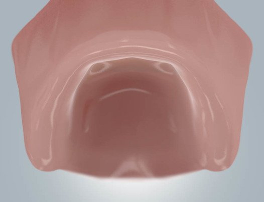 Schmuckfoto: Oberkiefer ohne Zähne / zahnloser Oberkiefer