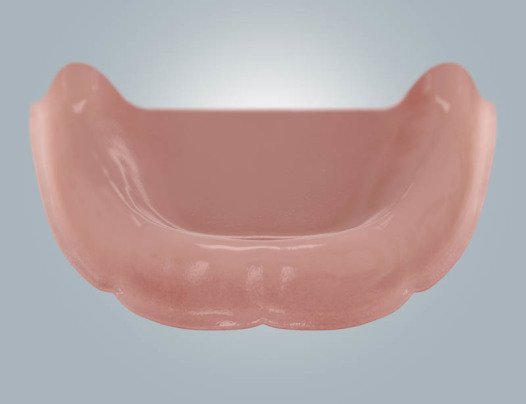 Schmuckfoto: Unterkiefer ohne Zähne / zahnloser Unterkiefer